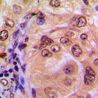 NF-kappaB p105 Rabbit Polyclonal Antibody