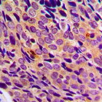 NF-kappaB p105/p50 Rabbit Polyclonal Antibody