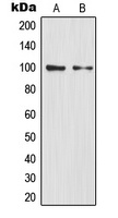 NF-kappaB p100 Antibody