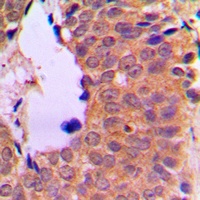 NF-kappaB p100 Antibody