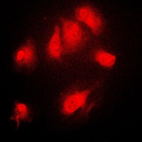 NFKBIA (phospho-S32/S36) antibody