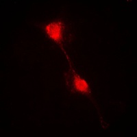 NFKBIA antibody