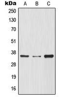 IKB alpha Antibody