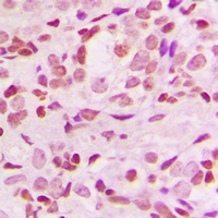 Anti-IKB alpha Antibody
