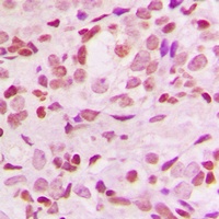 NFKBIA antibody