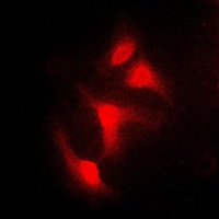 Anti-IKB alpha Antibody