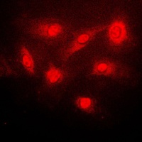 Anti-IKB beta (Phospho-S23) Antibody