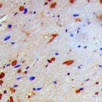 IKB beta (Phospho-T19) Antibody