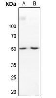 IKB beta Antibody