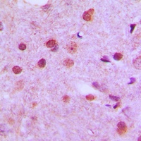 Anti-NFYC Antibody