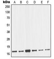 nm23-H2 Rabbit Polyclonal Antibody