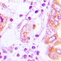 Anti-iNOS Antibody