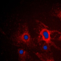 Anti-iNOS Antibody