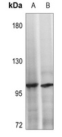 NOTCH2 Antibody
