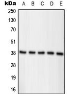 Nucleophosmin (Phospho-T234) Antibody