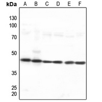 Nucleophosmin Rabbit Polyclonal Antibody