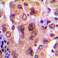 Nucleophosmin Rabbit Polyclonal Antibody