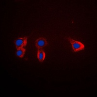 Anti-TRK B Antibody