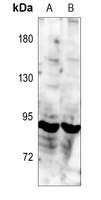 TRK C Antibody