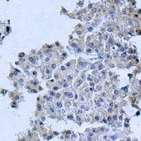 OCRL antibody