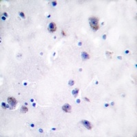 Mu Opioid Receptor (Phospho-S375) Antibody