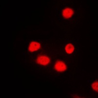 Anti-SIX6 Antibody