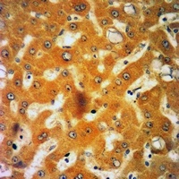 Anti-Orosomucoid 2 Antibody
