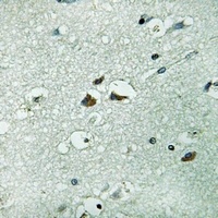 PAH Antibody