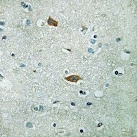 Anti-PAI2 Antibody