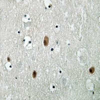 Anti-PAK3 (Phospho-S154) Antibody