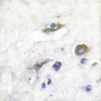 Anti-Parkin Antibody
