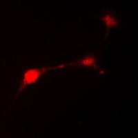 Parkin antibody