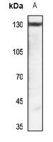 Pyruvate Carboxylase Rabbit Polyclonal Antibody