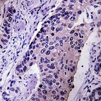Pyruvate Carboxylase Rabbit Polyclonal Antibody