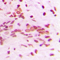 PCNA Antibody [KO/KD Validated]