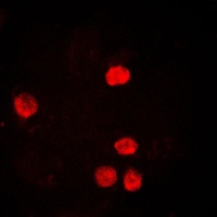 Anti-PCNA Antibody
