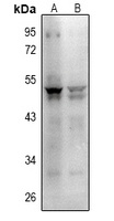 CD279 Antibody