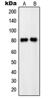 PDE4C Rabbit Polyclonal Antibody