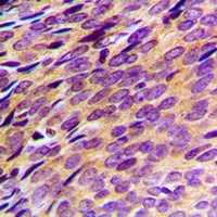 Anti-PDE4B/C/D Antibody