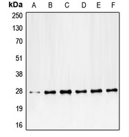 PDGFB Rabbit Polyclonal Antibody