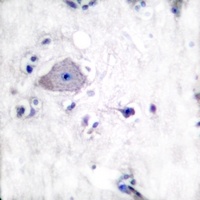 PDGFR alpha antibody