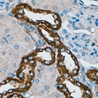 PDGFR beta antibody