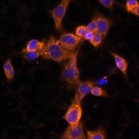 PDGFR beta antibody