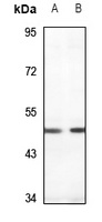 PDK1 Antibody
