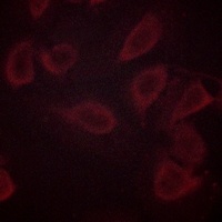 Anti-CD31 (Phospho-Y713) Antibody