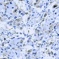 Anti-CD31 Antibody