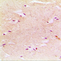 Anti-PEX14 Antibody