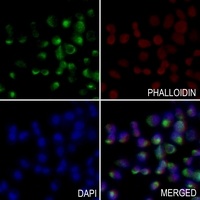 Anti-PEX14 Antibody