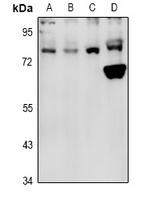 PFKL Antibody