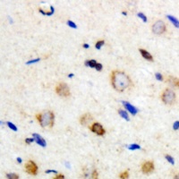 Anti-PFKL Antibody